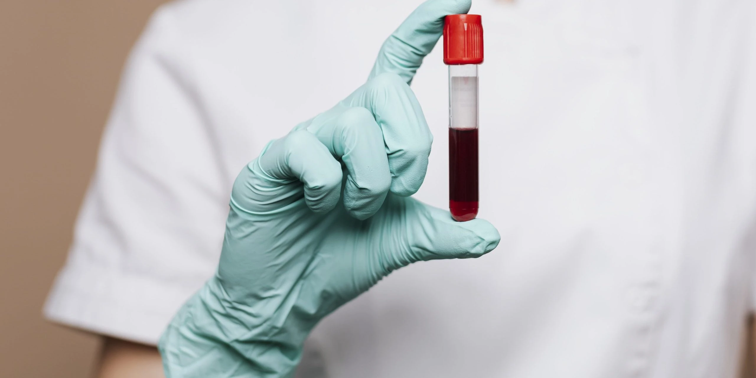 İskemik Hastalıklar İçin Ozon Tedavisi